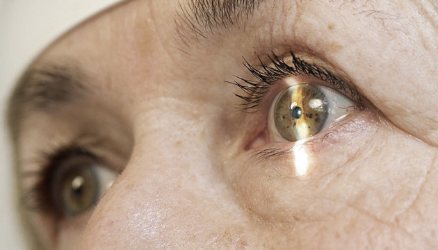 Заболевание глаз