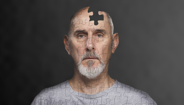 Болезнь Альцгеймера